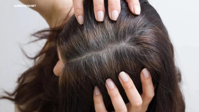 Preventing White Hair Naturally: Causes and Easy Methods 2024 Preventing-White-Hair-Naturally-Causes-and-Easy-Methods